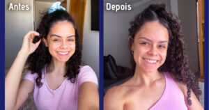 Antes e depois da utilização do The Cleansing Oil Bluz com resultados reais para a pele da embaixadora da beleza Bluz Jessica Xavier